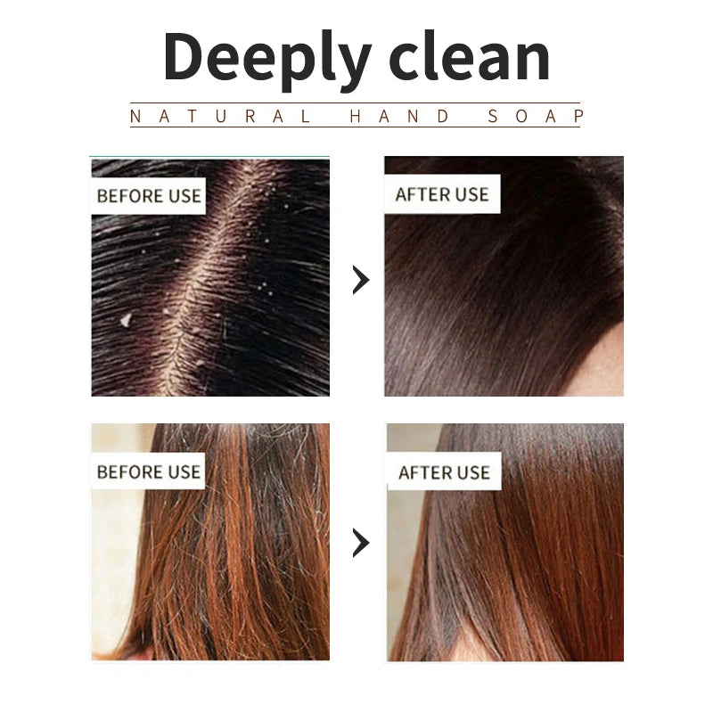 Lemon Plant Shampoo Is Refreshing, Oil Controlling, Dandruff Reducing, and Strong for Hair. Handmade Shampoo Without Silicone Oi